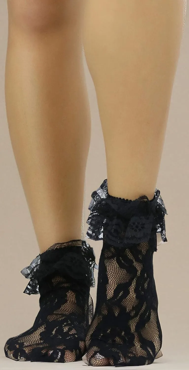 ToBeInStyle Women's Elegant Lace Anklet with Ruffle Cuff