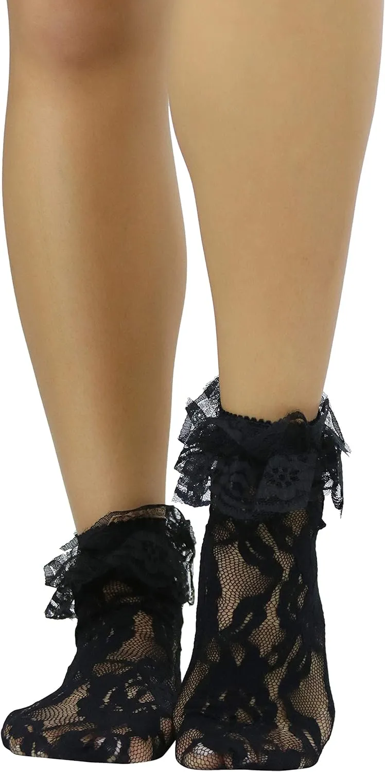 ToBeInStyle Women's Elegant Lace Anklet with Ruffle Cuff